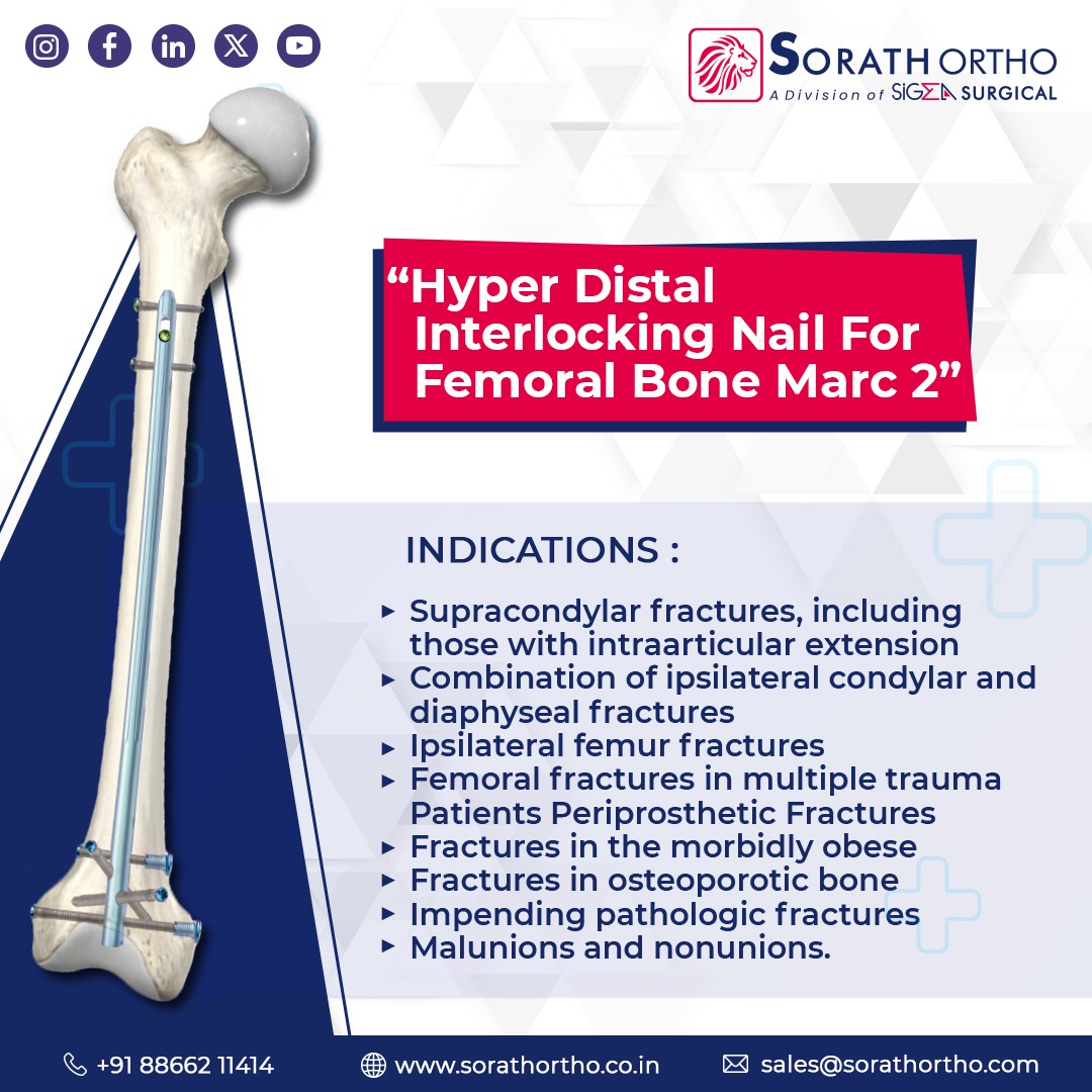 🌟Sorath Ortho is proud to present the latest breakthrough in orthopedic surgery: the Hyper Distal Interlocking Nail for Femoral Bone Marc 2! 🏥💪

#OrthoInnovation #FemoralFracture #Orthopedics #Innovation #HealthcareTech #OrthopedicImplants #Manufacturers #Implant #SorathOrtho