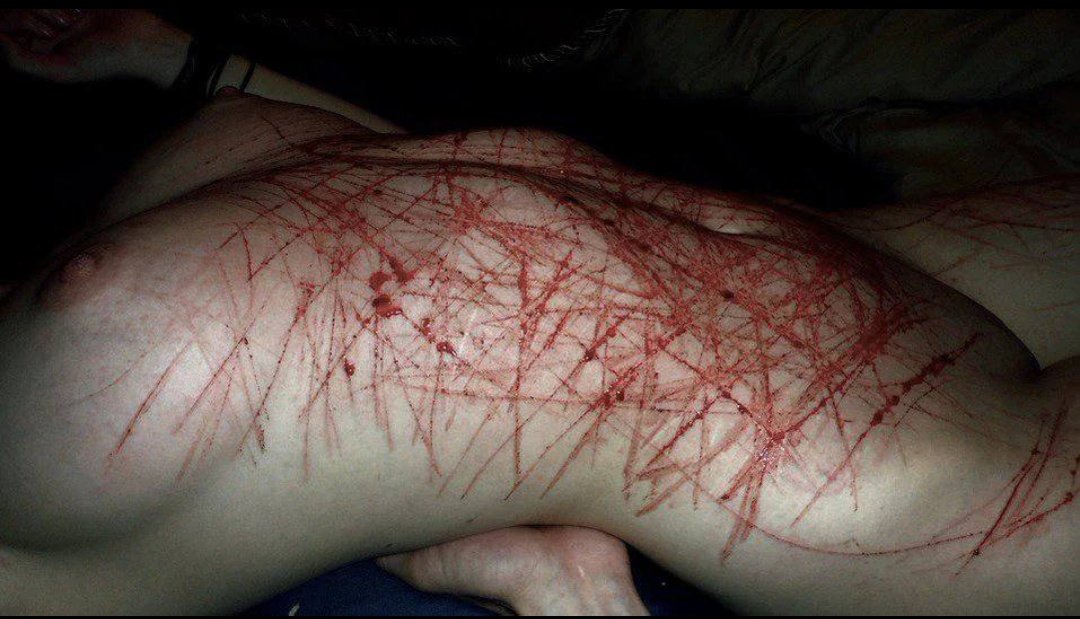 mi imperio romano siempre va a ser cortarme así hasta que pienso q al otro día no me voy a poder poner ni un remeron y se me pasa