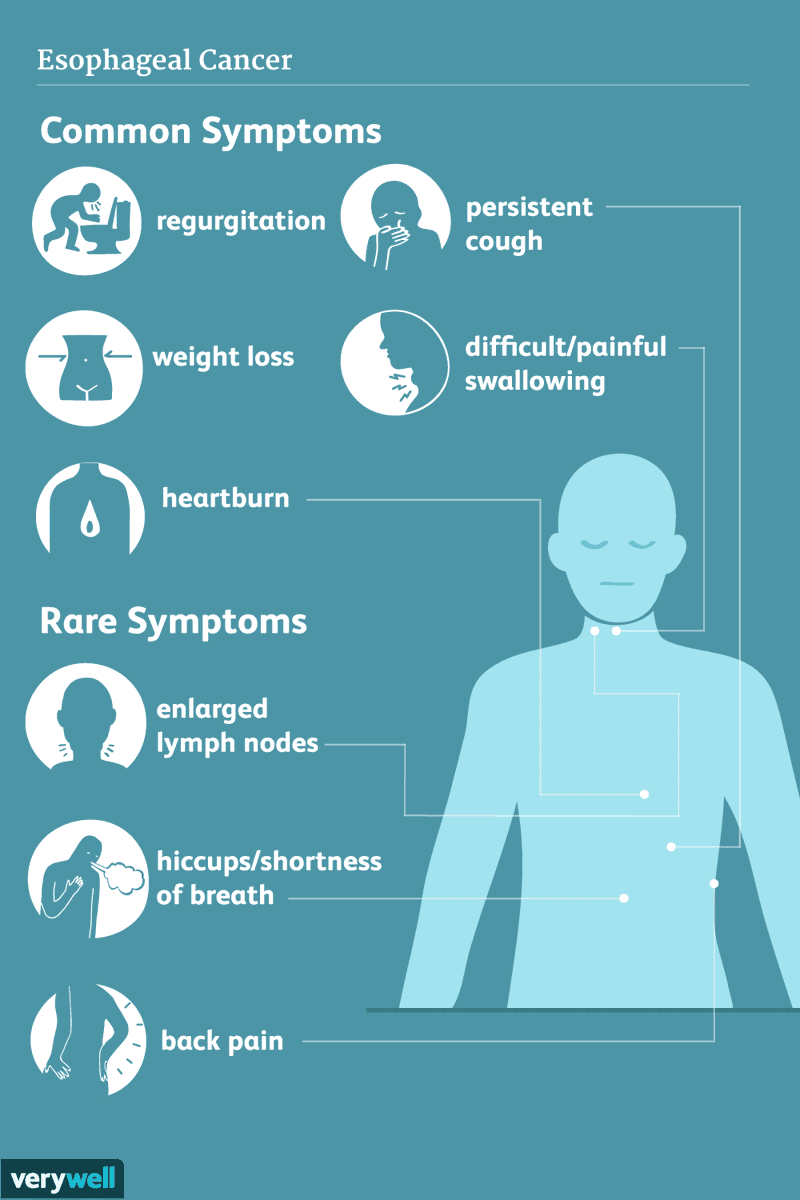 Know the signs of #EsophagealCancer. Keep an eye out for difficulty swallowing, hoarseness, persistent cough, weight loss, or increased indigestion/heartburn. Talk to your doctor about screening if you notice any of these symptoms. Early detection is key!