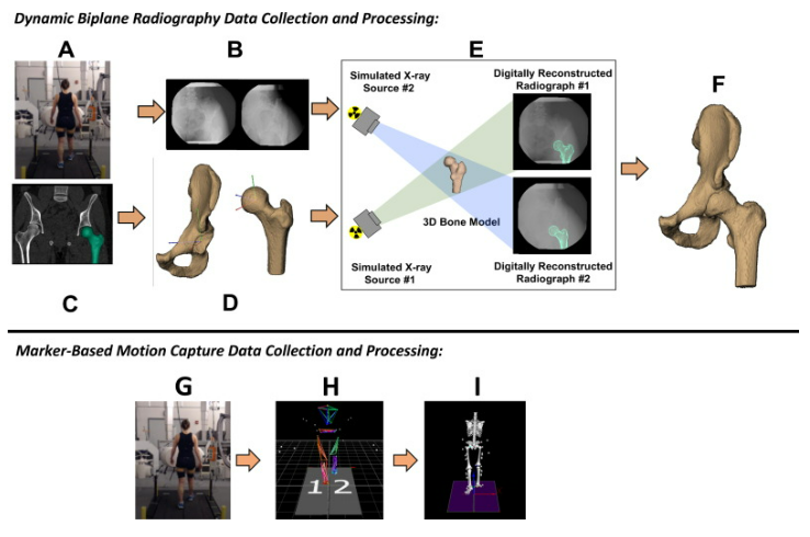 New publication on the accuracy of motion capture in estimating the hip joint center! 🎉🎉doi.org/10.1016/j.jbio…