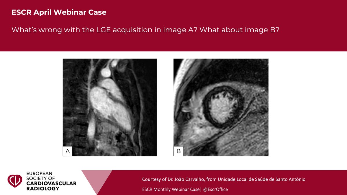 Get ready for the April #ESCR special teaser case! 🫀🧐 Do you know the answer? 🔎 Join our upcoming ESCR webinar “10 steps to cardiovascular MRI”, on April 17, 18:00 CEST, to find out the solution. Click here to register free of charge 😍👇 us06web.zoom.us/.../WN_f75QQPN…...