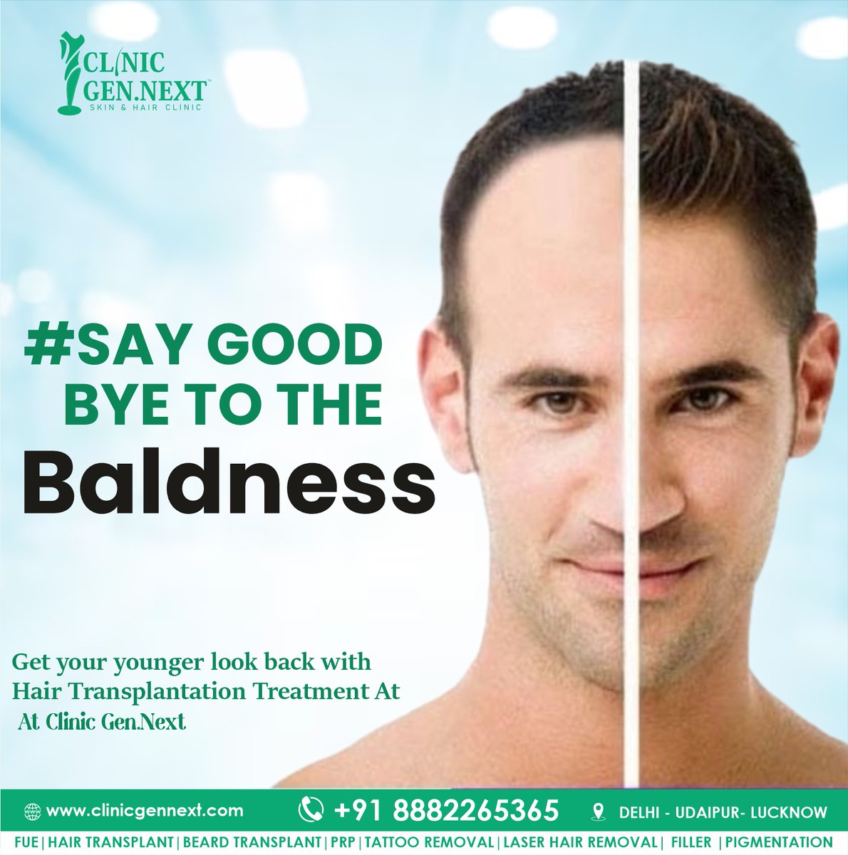 Say Good Bye To The BALDNESS

Get HAIR TRANSPLANT
#ClinicGenNext #HairTransplant #SkinTreatment #Wrinkles #Moles #Acne #SkinCare #HairLossSolution #ConfidenceBoost #FUE #FUT #FreeConsultation #HairCare #Dermatology #Skintreatment #Skinproblem #Wrinkles #Moles #Blackheads #Acne