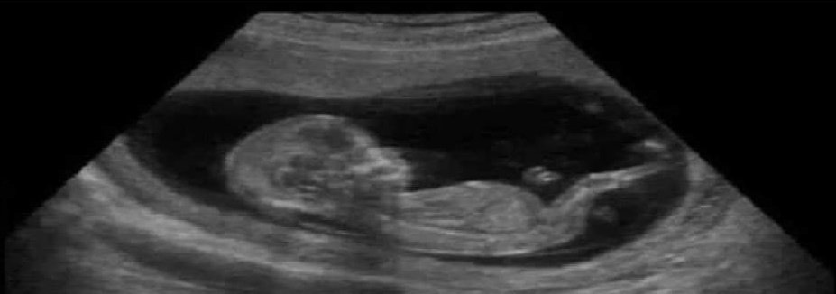 Yo en 1995 perdiendo el tiempo en vez de comprar viviendas baratas.