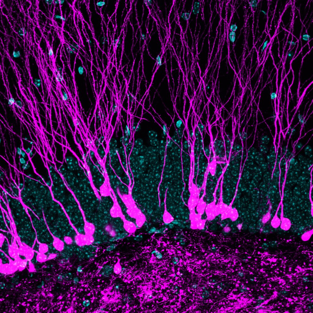 Wissenschaftler:innen der @UniCologne haben entdeckt, wie Mitochondrien die Zellerneuerung und die neuronale Plastizität im Gehirn der erwachsenen Maus steuern. cell.com/neuron/fulltex… Bild: Bergami Labor