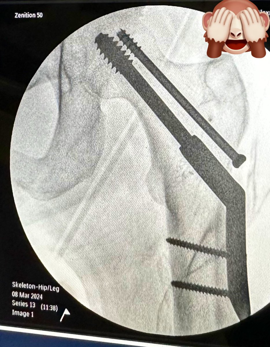 Keatesy  ツ tweet media