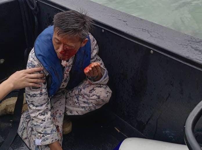 redzuanNewsMPB's tweet photo. Anggota APMM, Bintara Muda Maritim Zainal Abad Komel, 45 yang ditembak perompak laut di perairan Kunak semalam disahkan buta.

Prosedur keluar peluru pada mata kiri ambil masa dua jam namun mata itu tidak dapat diselamatkan apabila peluru terkena pada saraf. https://t.co/OJJt8eW6g4