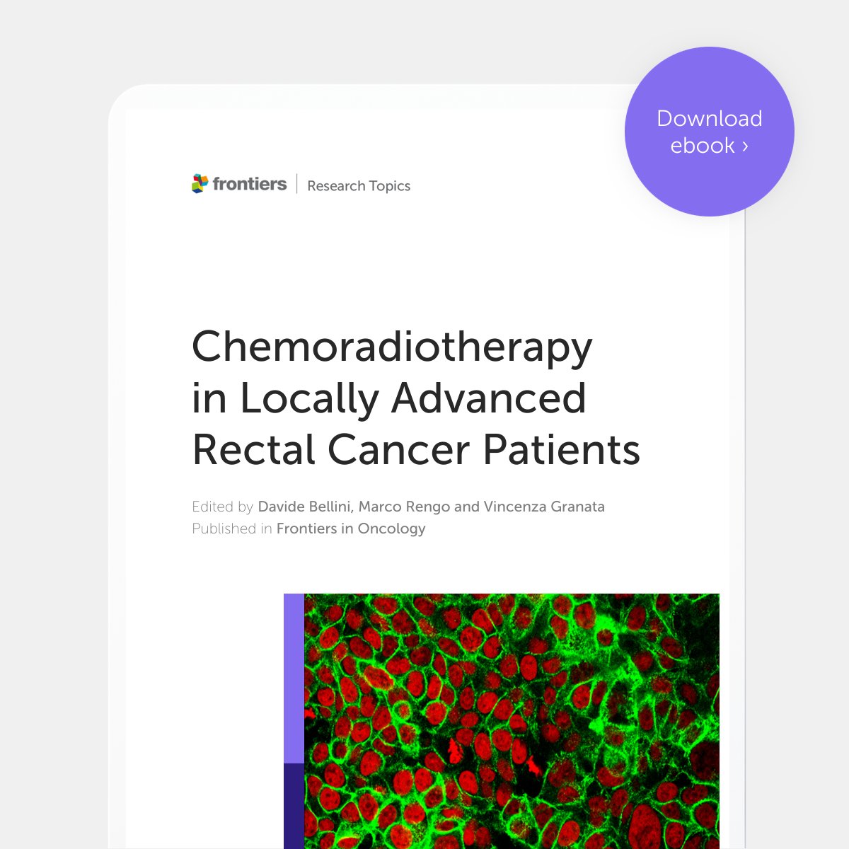 📢 Our new eBook 'Chemoradiotherapy in Locally Advanced Rectal Cancer Patients' is now available to download for free! 🧑‍🔬Edited by Davide Bellini, Marco Rengo and Vincenza Granata Download your free copy here 👉fro.ntiers.in/RT50856