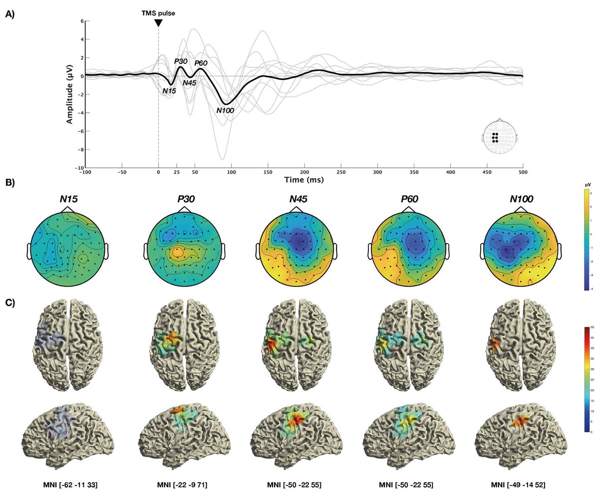 MEXTproject (@mext_project) on Twitter photo Variability during 1 Hz rTMS in detail: different temporal progressions, fluctuations, and effect plateaus of cortical excitability in MEPs and TEPs. 🔀
Congrats <a href="/schoisswohl/">Stefan Schoisswohl</a> on this groundbreaking publication! 👏
doi.org/10.1523/eneuro…
<a href="/dtecbw/">dtec.bw</a> <a href="/unibw_m/">UniBw M</a> <a href="/uni_regensburg/">Universität Regensburg</a> Variability during 1 Hz rTMS in detail: different temporal progressions, fluctuations, and effect plateaus of cortical excitability in MEPs and TEPs. 🔀
Congrats <a href="/schoisswohl/">Stefan Schoisswohl</a> on this groundbreaking publication! 👏
doi.org/10.1523/eneuro…
<a href="/dtecbw/">dtec.bw</a> <a href="/unibw_m/">UniBw M</a> <a href="/uni_regensburg/">Universität Regensburg</a>