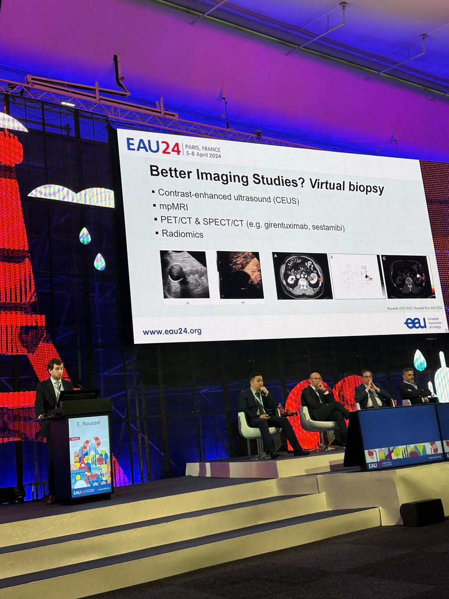 Maarten Albersen (@maartenalbersen) on Twitter photo <a href="/Eduardrssl/">Eduard Roussel</a> airlines 🚀 departing now in plenary. Considerate and balanced talk on Bosniak 2-3 cyst management in the rapid fire debates on RCC <a href="/Eduardrssl/">Eduard Roussel</a> airlines 🚀 departing now in plenary. Considerate and balanced talk on Bosniak 2-3 cyst management in the rapid fire debates on RCC