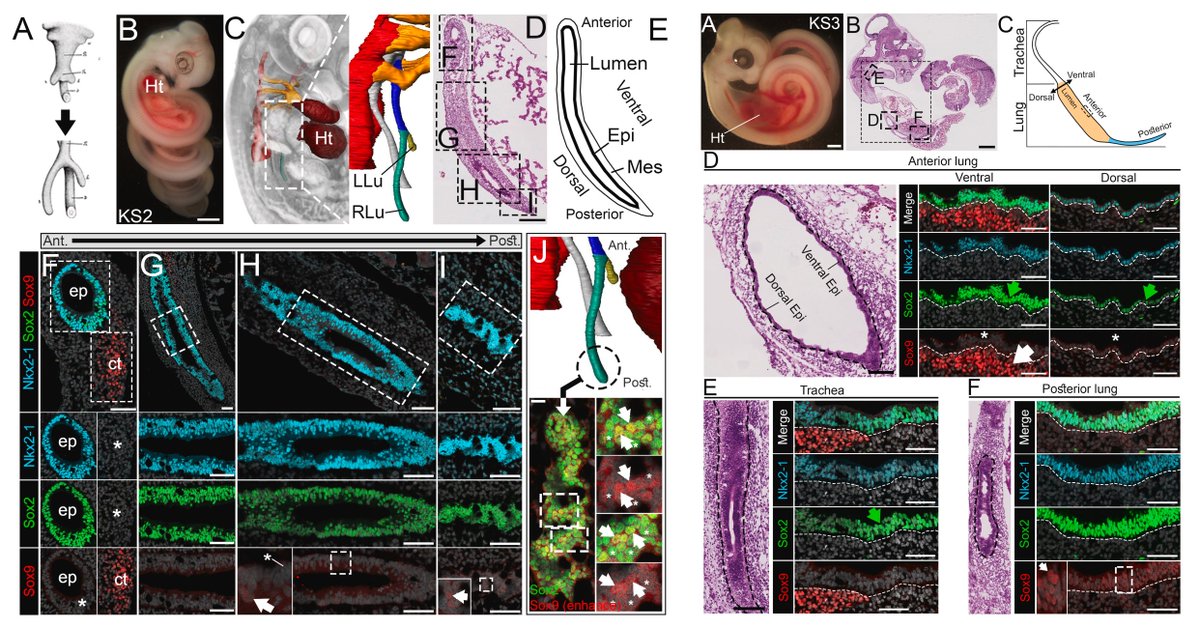 #DBfeature 🐍🫁 Sox9 is associated with two distinct patterning events during Snake Lung morphogenesis by Benjamin van Soldt, Wellington Cardoso et al @BSoldt sciencedirect.com/science/articl…