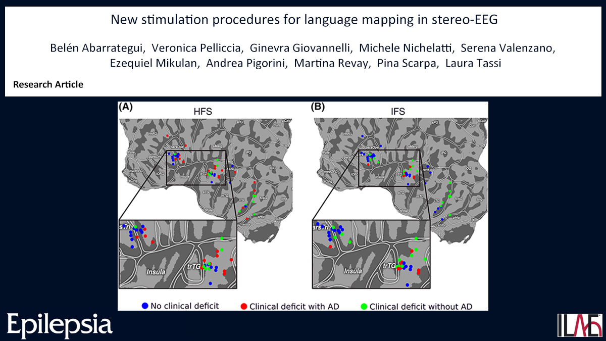 Key point: Intermediate frequency stimulations (6–15 Hz) emerge as a useful tool for #language mapping with stereo–electroencephalography. doi.org/10.1111/epi.17… #epilepsy #ILAE #epilepsysurgery #functionalmapping #neurophysiology @IlaeWeb @epilepsiajourn @WileyNeuro
