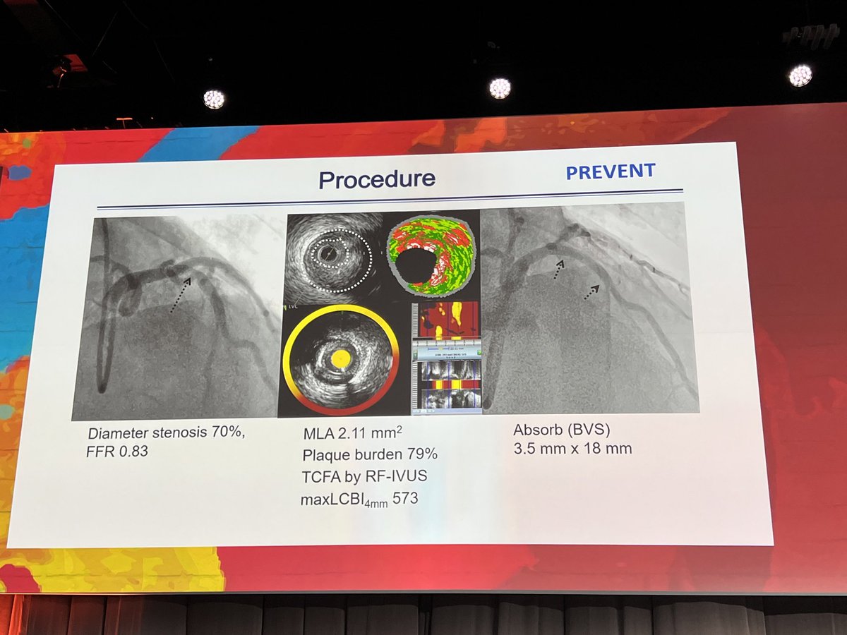 Dr Roxana Mehran tweet media