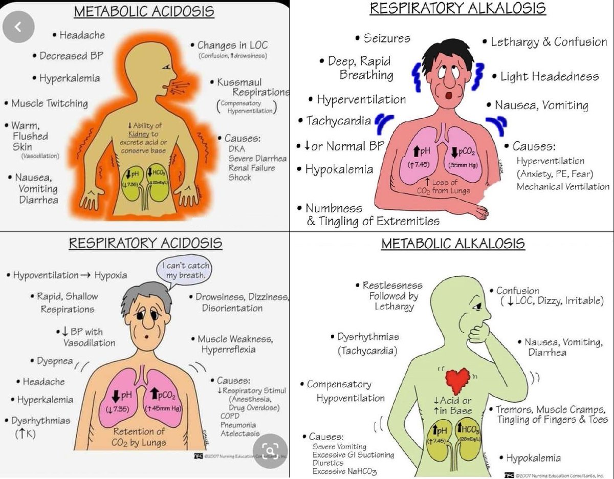 ManualOMedicine's tweet photo. @DrPharmDMDTh Acid-Base Disorders https://t.co/HDnYFIOpgk
