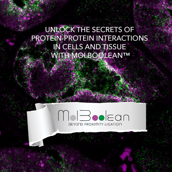 🎉 Exciting news! - Beyond Proximity Ligation - Unlock the secrets of protein-protein interactions in cells and tissue with MolBoolean™ A revolutionary proximity ligation assay from Atlas Antibodies! atlasantibodies.com/company/compan… #atlasantibodies #proximityligation #insitupla