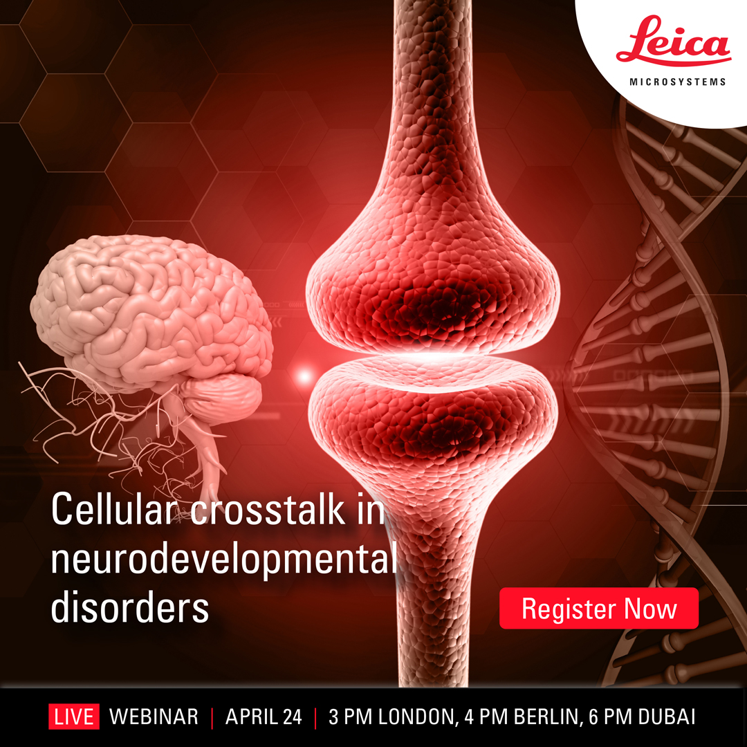 🧠 How do cells talk to each other during brain formation? Explore the role of cellular crosstalk in neurodevelopmental disorders in our live webinar with Prof. Silvia Cappello from LMU Munich. @silvianeurompi Register Now 👉️ fcld.ly/u5ud113