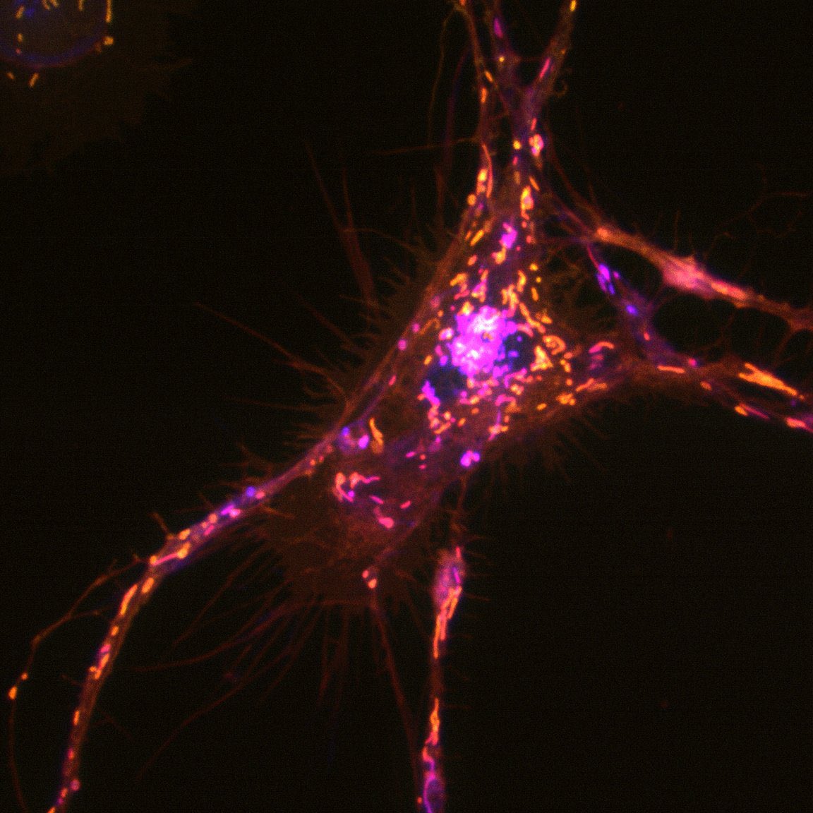 Let’s start this #microscopymonday with some mighty-chondria !