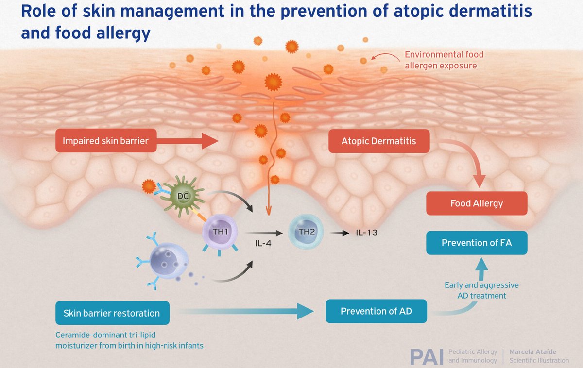 Have you read the #review titled “Role of #sSkinManagement in the prevention of #AtopicDermatitis and #FoodAllergy” published by Elizabeth Huiwen Tham et al.? Take a look here: 🔗 doi.org/10.1111/pai.14… #PAI_Journal