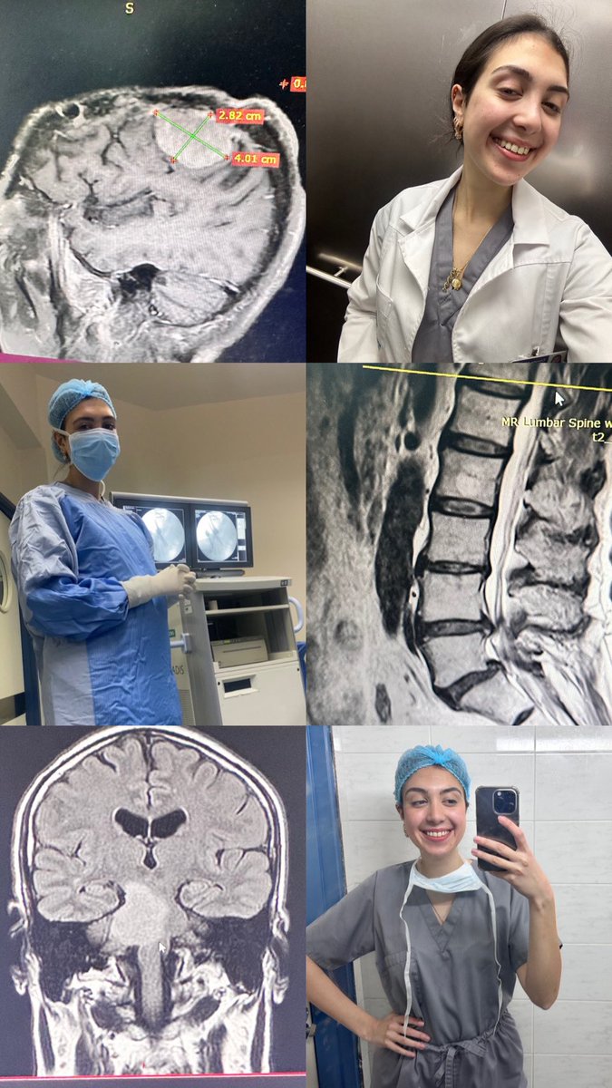 Some more captured moments from my #Neurosurgery rotation 🧠❤️