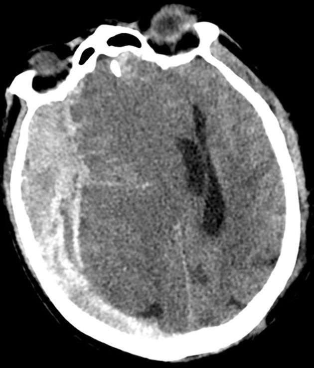 ¿Por qué la edad es un factor de riesgo en el Trauma? Traemos el #ArtículoRecomendadoDelLunes 🕵 ➡️ buff.ly/3TQxbH5 #FOAMrad #FOAMed @SERAM_RX @SEICAT_RAD @mkserme @SENR_org @sediabdomen SERAM - Sociedad Española de Radiología Médica.