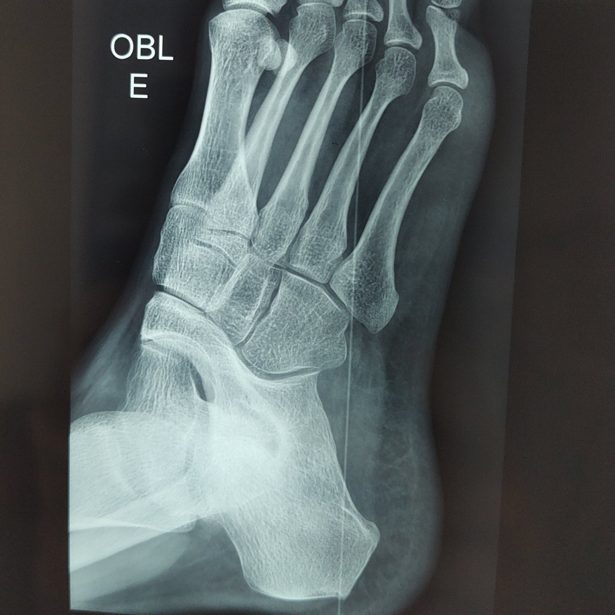 What is the sign? Answer in GIFs 🤓

#OrthoTwitter