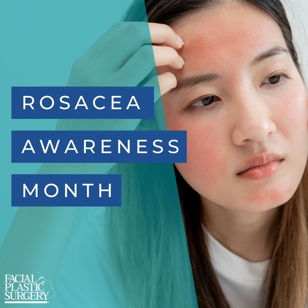 April is #RosaceaAwarenessMonth. Over 415 million people worldwide suffer from rosacea*. If you’re among the many, there are skincare treatments like laser therapy & intense pulsed light therapy your #FPS can recommend. bit.ly/AAFPRSphysicia… #AAFPRS Source: @rosaceaorg