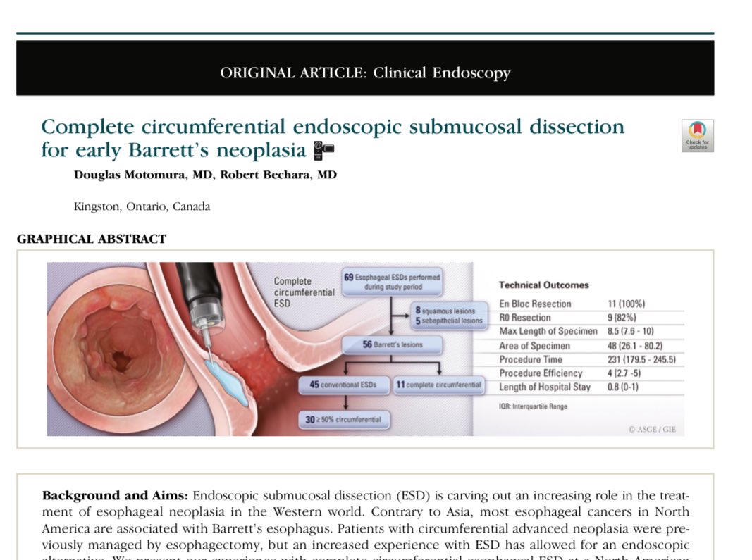 Fantastic article in @GIE_Journal by @RobertBechara & @DouglasMotomura sharing experience of circumferential esophageal ESD ✂️ for Barretts neoplasia ✅ 100 % en-bloc resection ✅ 82% R0 resection ⁉️ Post ESD stricture mostly tx by dil giejournal.org/article/S0016-… @DouglasAdlerMD