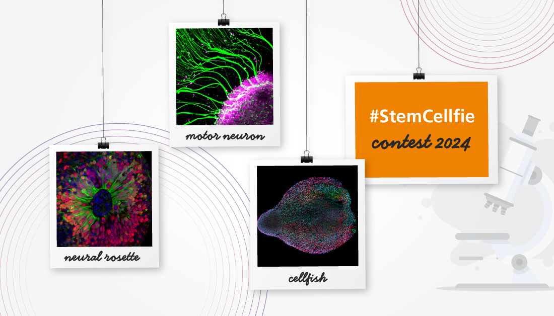STEMCELLTech's tweet photo. Ready, set, go! We're thrilled to announce the official start of the 2024 #StemCellfie contest. 🤳🧫 #SciArt

From now until 11:59 am PDT on April 19th, submit your best #cellfie for a chance to win prizes, including a magnetic puzzle of your submission: https://t.co/u0jb9sslXu https://t.co/Y67OyDLsyy