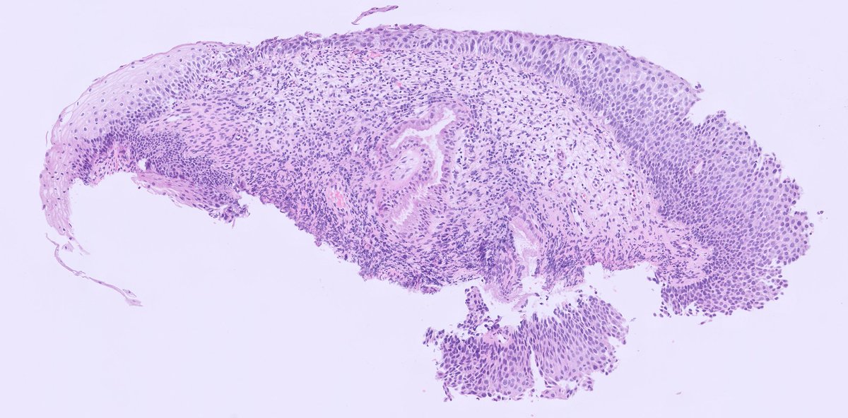 Lorand Kis tweet media