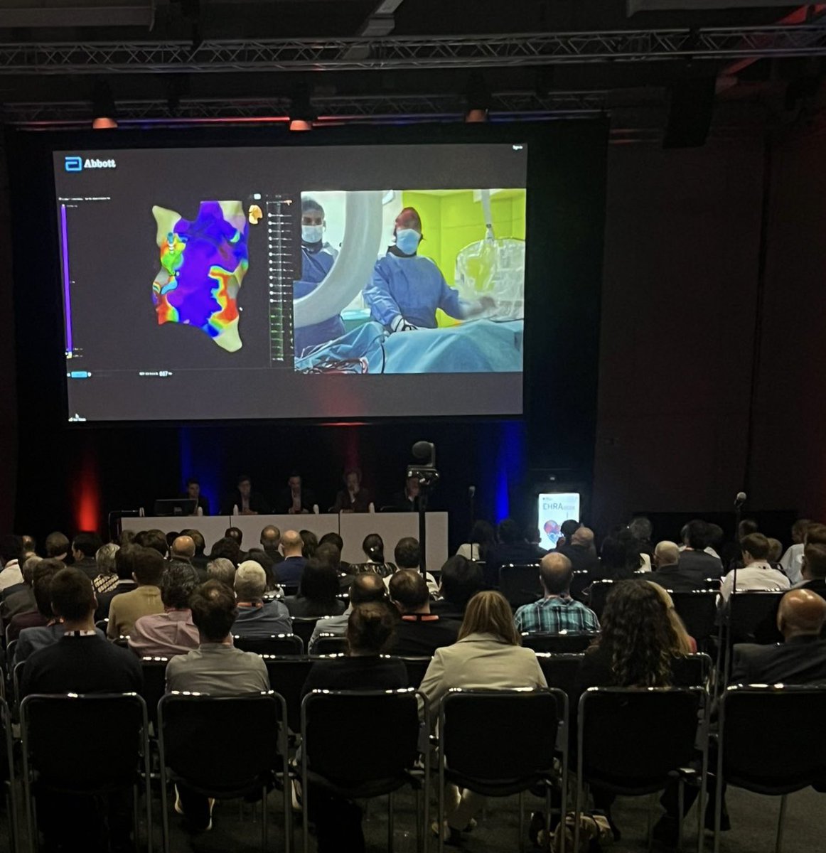 Honoured to have perfomed a live case in #EHRA2024 of a 3rd procedure of refractory AVNT…finally #3Dmapping and LEFT side approach did the job. @hospitalclinic @aportasanchez @tolosanaviu @LluisMont2 @arbelo_e @EduGuasch @guichard_jb @TillAlthoff