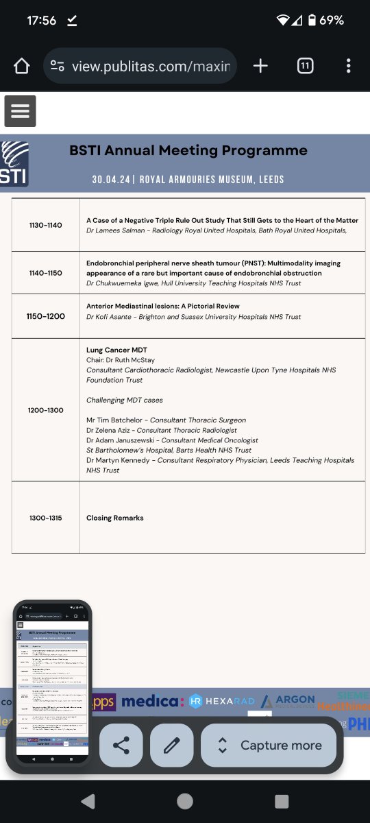 This is our agenda for the ASM this month We are looking forward to seeing you all there!@juniorBSTI <a href="/RCRadiologists/">The Royal College of Radiologists</a> <a href="/SCoRMembers/">SCoR Members</a>  .