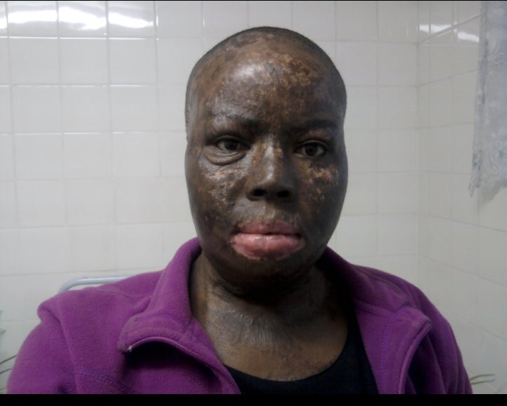 That’s how it all started and I stayed and hoped for a change.,,and it got worse

And look how it escalated 

So if you come across this post and you think they will stop they won’t

Run , fly if you can while you still can

Don’t be a statistic🌻🥂👌