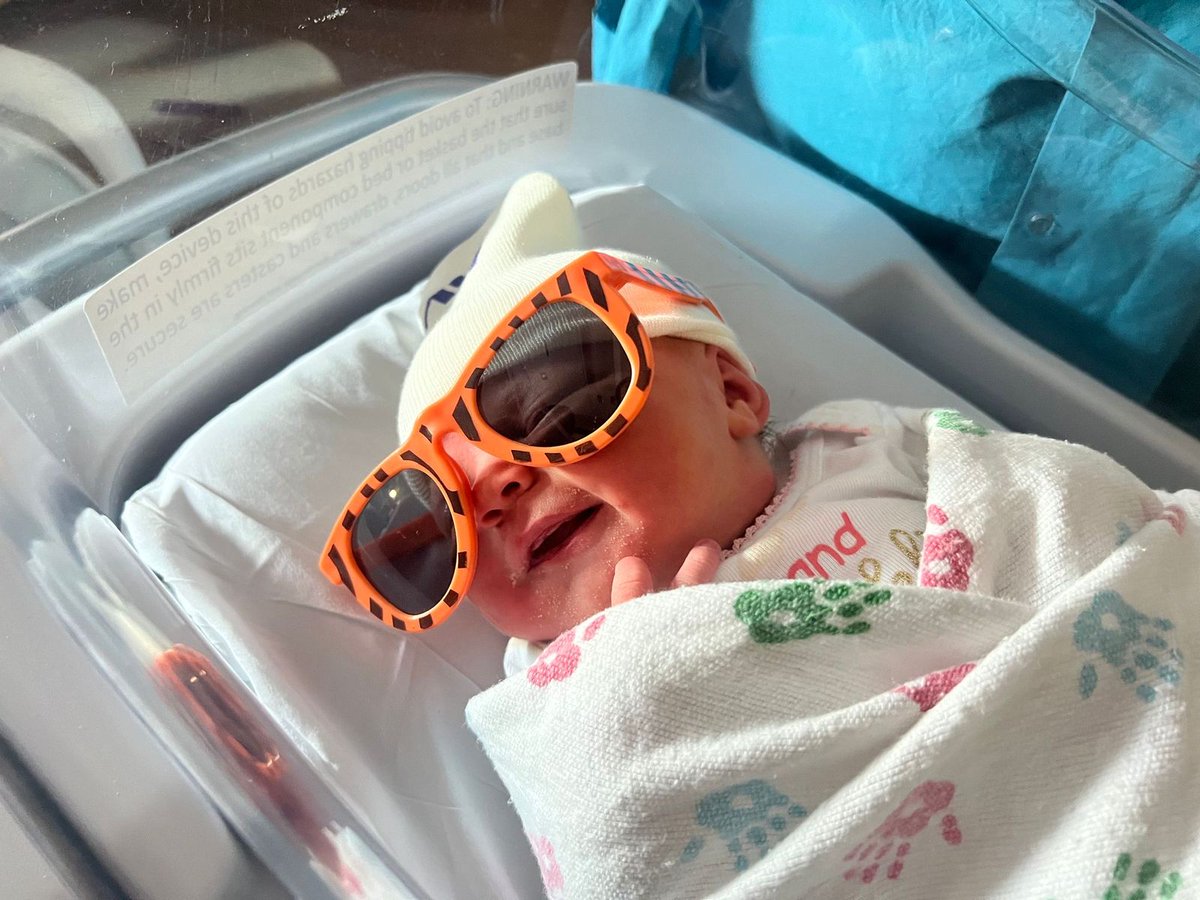 Eclipse babies: Babies born at Northwestern Medicine Huntley Hospital today received sunglasses.