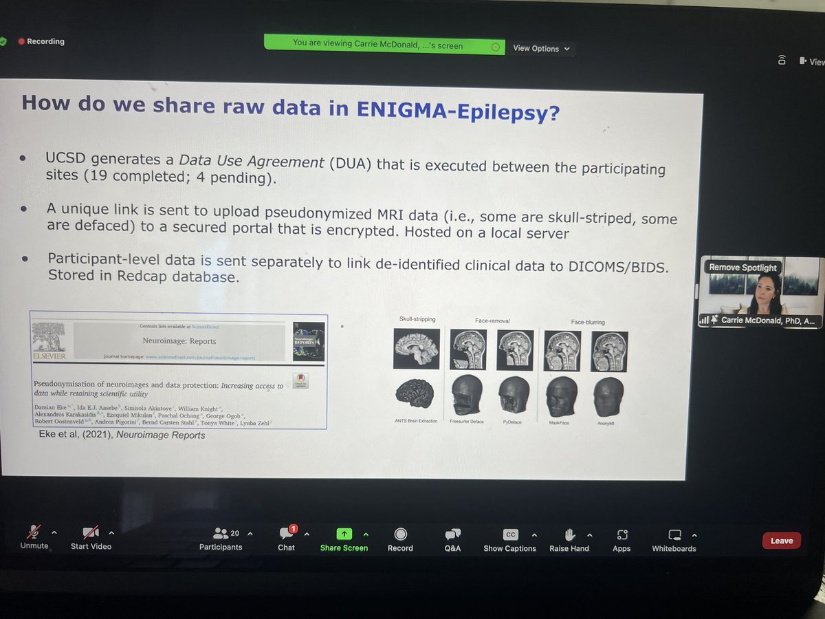 @enigmabrains ENIGMA Epilepsy has carefully considered the most efficient way to share data while keeping data de-identified.