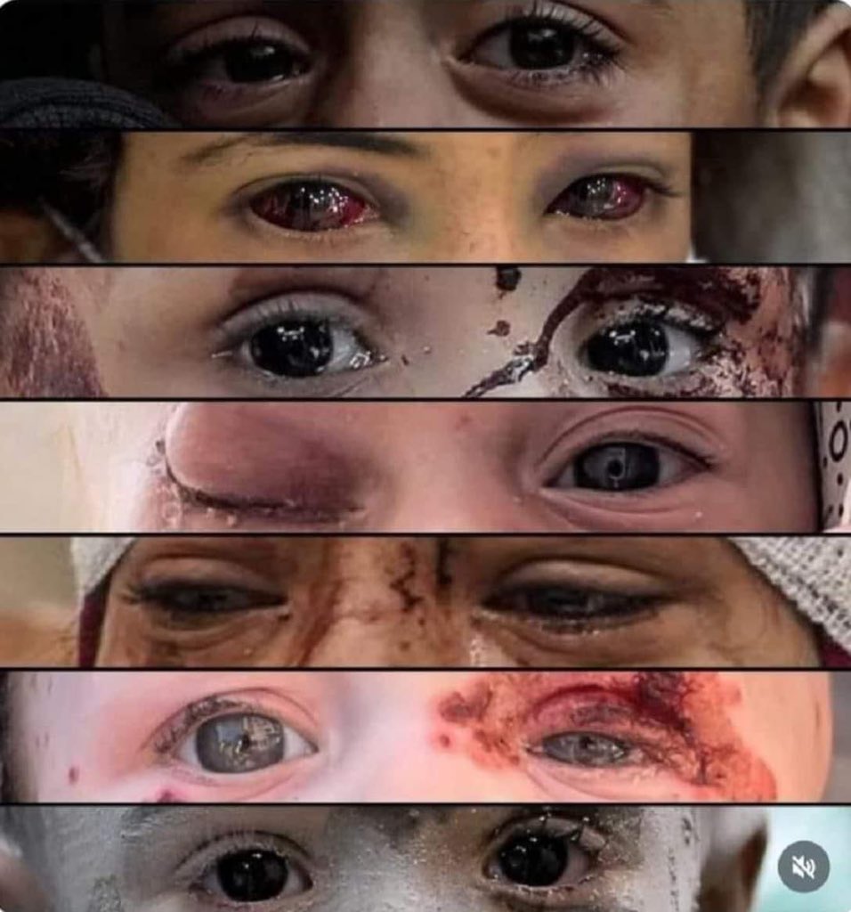 A world’s reflection in eyes from Gaza.