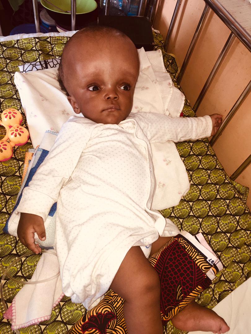 good evening, twitter.

this post comes after a period of deliberation, and i have come to the conclusion that i need your help.

please save my second cousin.

his name is Benaiah Success, a 6 month old child who was diagnosed with hydrocephalus 6 weeks from his birth.