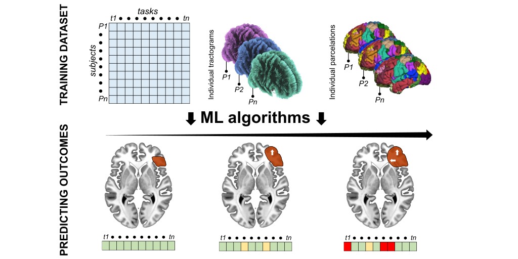 Herbet et al. examine how machine learning algorithms can be used to predict cognitive outcomes following glioma resection. They argue that three factors should be used as predictors: resection topography, structure-function phenotype, and neuroplasticity. tinyurl.com/2s4abfbh