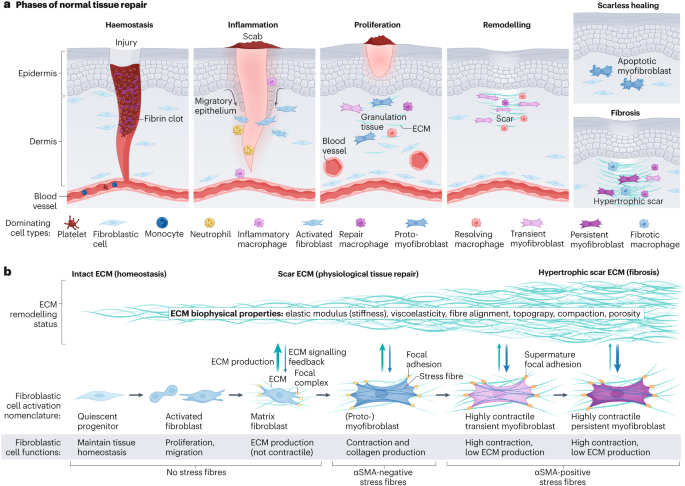 Now Online Fibroblast and myofibroblast activation in normal tissue repair and fibrosis dlvr.it/T5FQMp