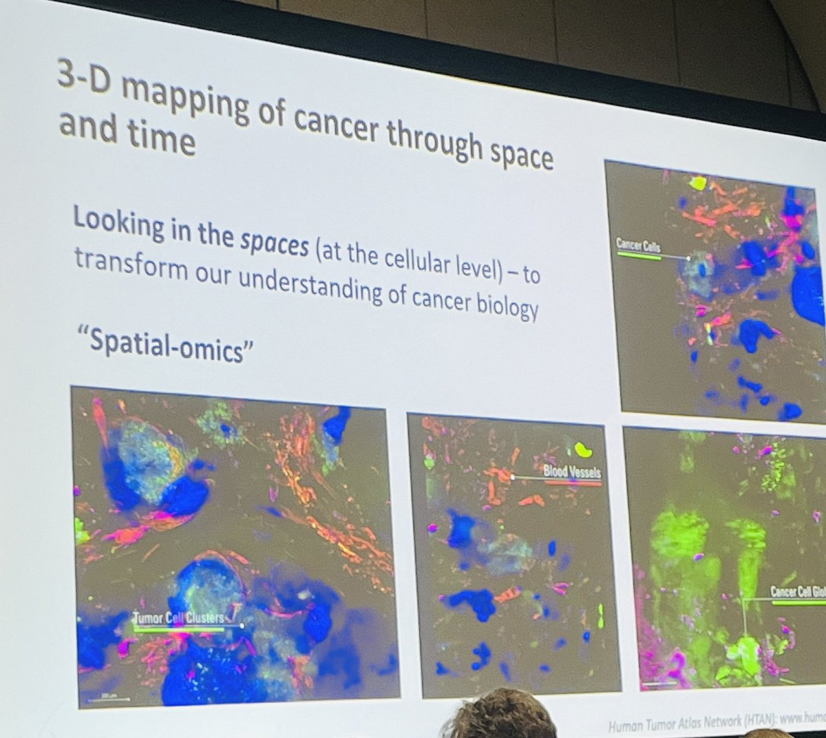 “3D mapping allowing to directly visualise cell-cell interactions will soon transform how we understand tumor biology”. Excited <a href="/AACR/">AACR</a> annual meeting. Visionary NCI director Kimryn Rathmell.