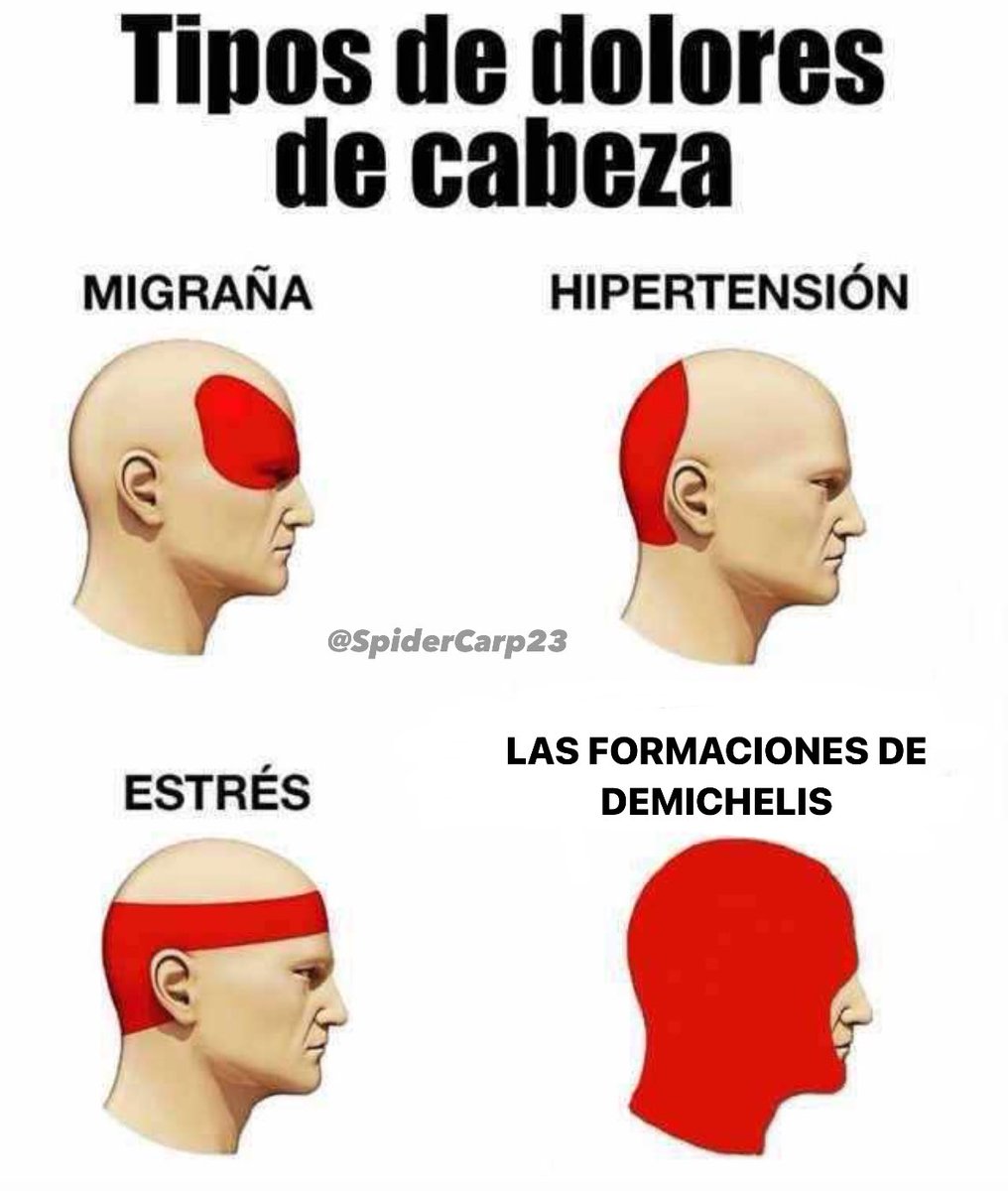 La puta que te pario Demichelis