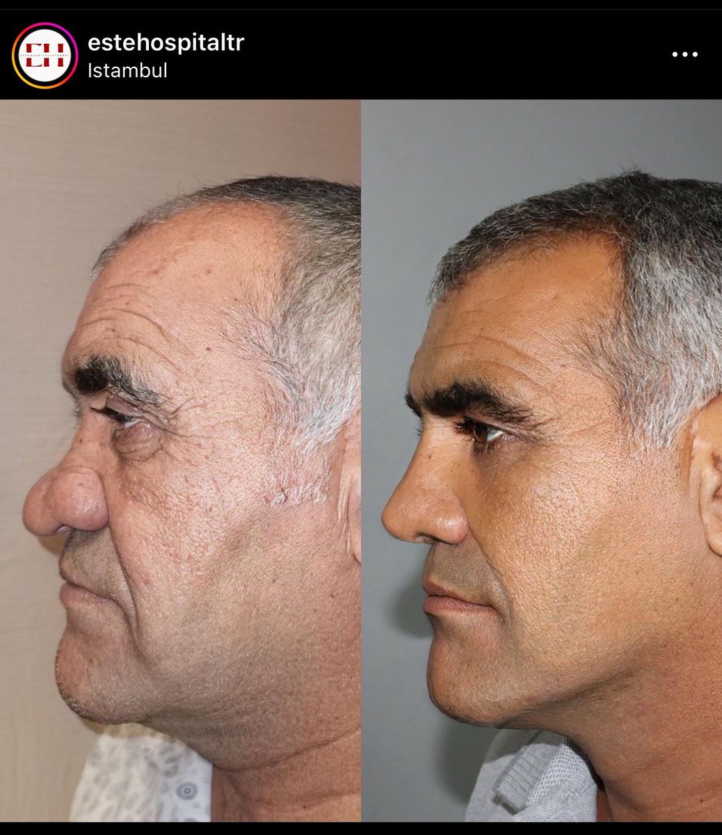 vovo turbo tetuda apreciadora de cachaça tweet media