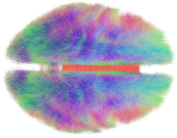 The HCP 1000 structural connectome finally has a proper scientific citation: nature.com/articles/s4159… Not just for DBS network mapping, also for structural fingerprinting using @leaddbs e.g. as done by Kringelbach/Deco groups or by @boeslab for lesion network mapping.