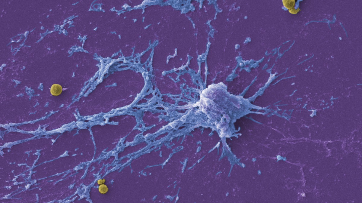 So excited to have this awesome collaborative work finally out! Congrats @cstefani06 @adamlacyhulbert! We found that ctenophore (comb jelly) immune cells produce DNA traps as an antimicrobial defense, similar to the behavior of vertebrate neutrophils. 1/ nature.com/articles/s4146…