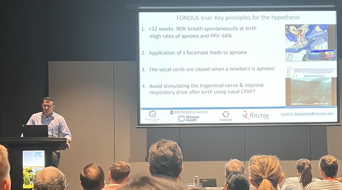 ⁦The FONDUE trial of nasal CPAP compared with face mask in the DR for very preterm infants presented by @Doug17683115⁩ ⁦@mypsanz⁩ We are making lots of breathing babies apnoeic with face masks… Are nasal prongs/nasal masks a better alternative? #neotwitter