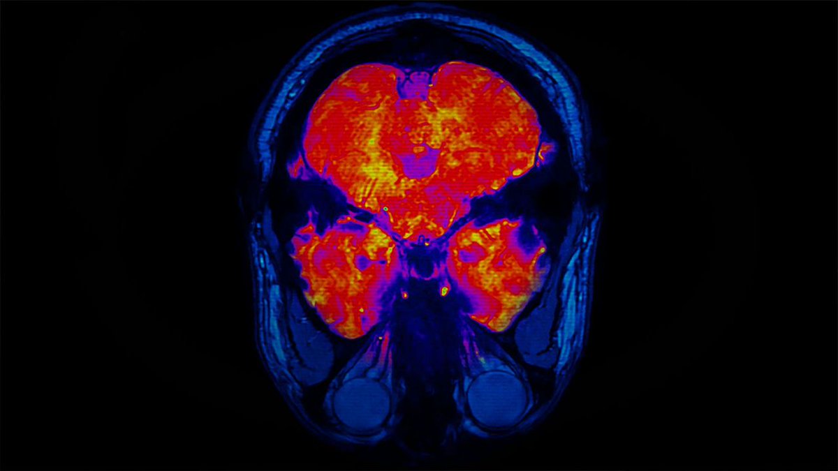 An interesting commute-watch! How your brain changes as you age… it's not all bad news! economist.com/films/2023/10/…?