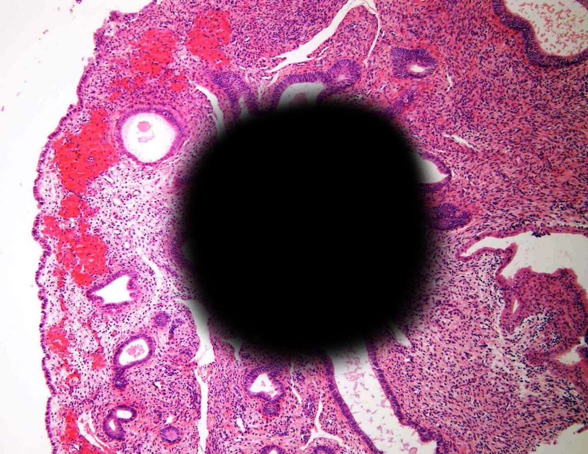 UW Dept of Pathology and Laboratory Medicine tweet media