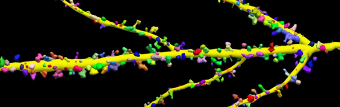 ScitechPtyLtd's tweet photo. Neurolucida®360 from @MBFBioscience
The most advanced software designed for automatic 3D & 2D neuron reconstruction from acquired images from #brightfield, #fluorescence, #confocal & #lightsheet #microscopy techniques.
#neuroscience #neuroresearch https://t.co/WIHQTqtzka