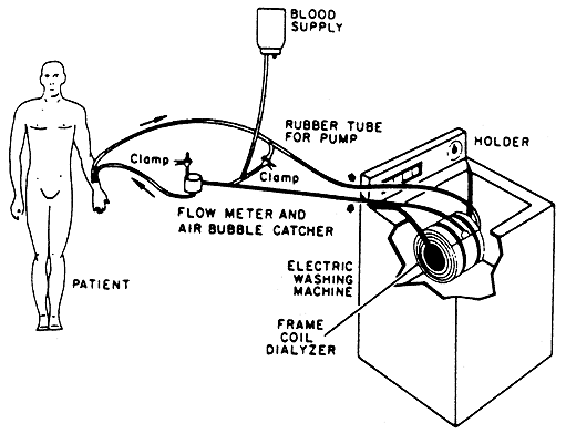 Hemodialysis in the 1960's. A washing machine was used! edren.org/ren/unit/histo…
