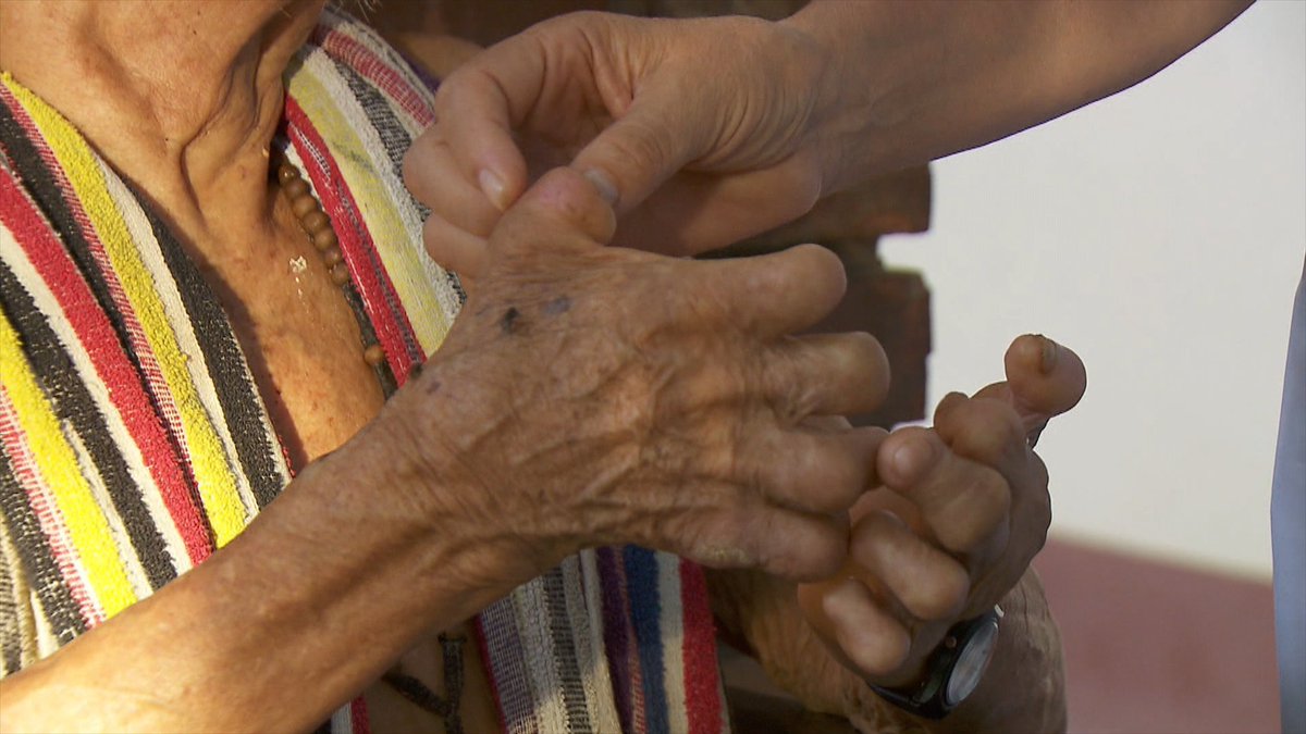 ¿Sabías que la presencia salesiana en Agua de Dios 🇨🇴sigue aliviando las heridas de un pueblo creado en el siglo XIX para personas con lepra ? 📅Domingo 14 abril 2024 ⏰11:30h (España peninsular) 📷En @la2_tve de @rtve @rtveplay y #TVEInternacional