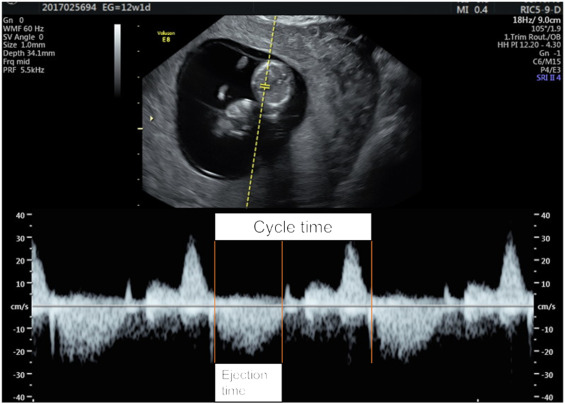 Assessment of fetal cardiac function in early fetal life: feasibility, reproducibility, and early fetal nomograms - tinyurl.com/kpy9wvn8