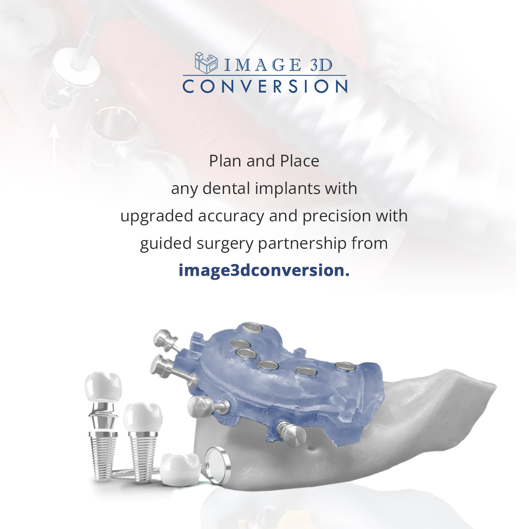 Plan and Place any dental implants with upgraded accuracy and precision with guided surgery partnership from image3dconversion
DM us for details or Email at info@image3dconversion.com
#image3dconversion #guidedimplantsurgery #blueskyplan #dentaleducation #allonxdentistry